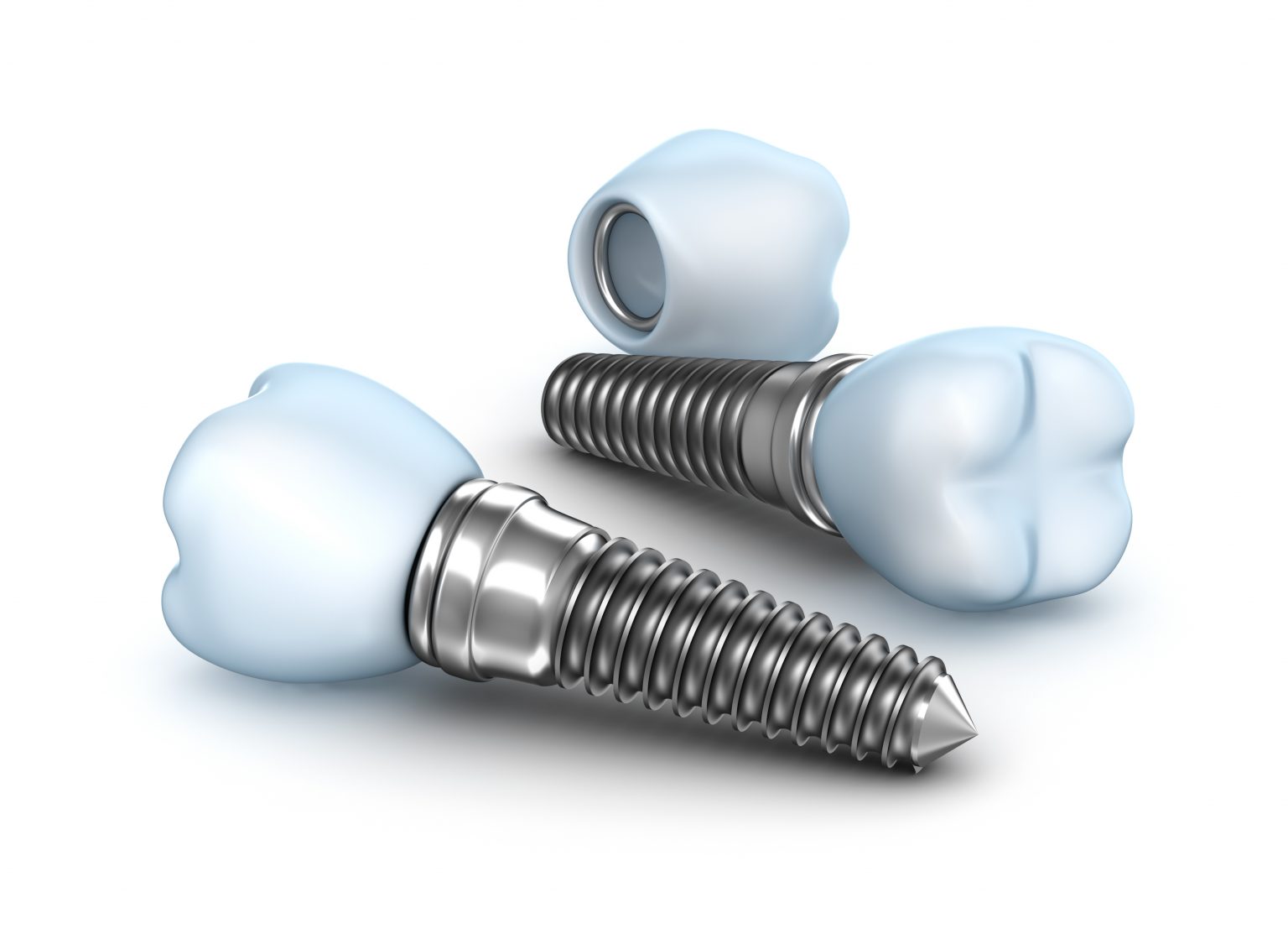 Dental Implants Can Replace Your Dentures Chicago Dentist Implant